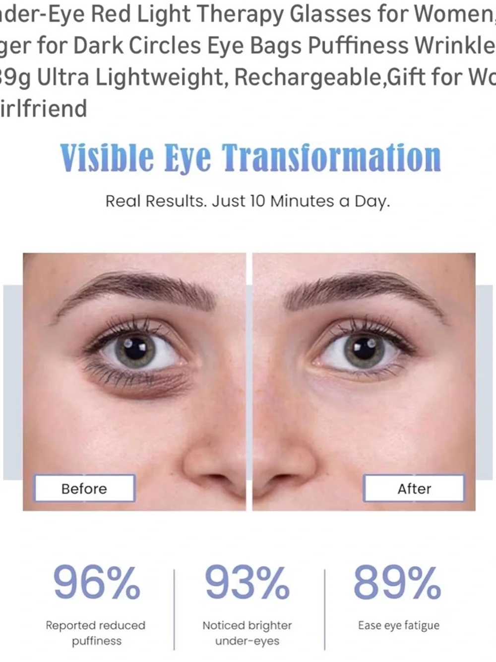 UTK eye simple home