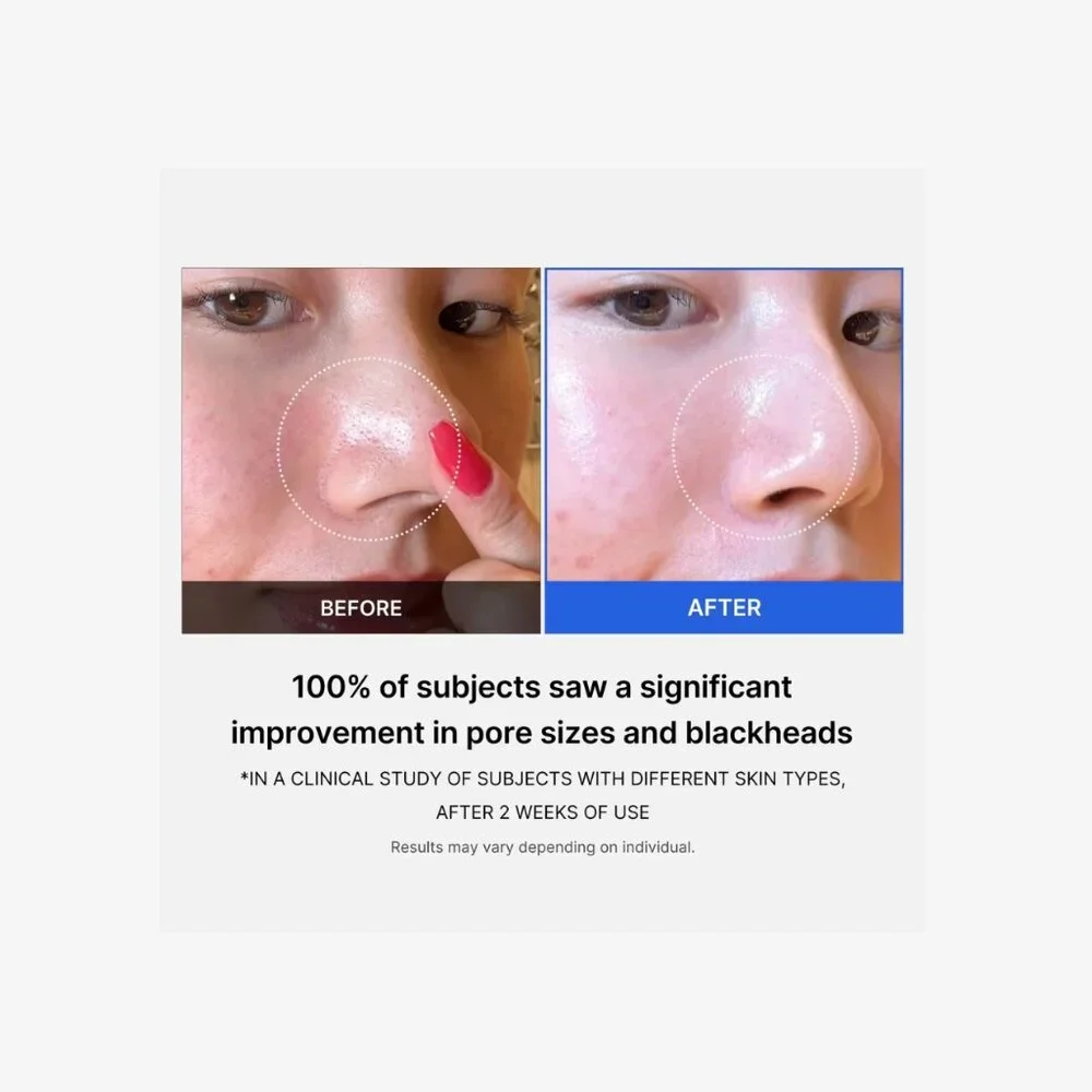 Medicube exfoliates refines