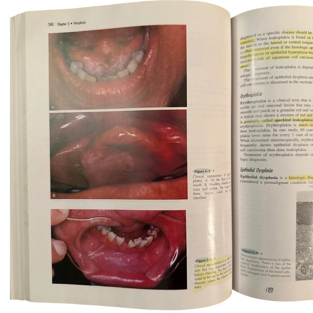 N/A oral pathology